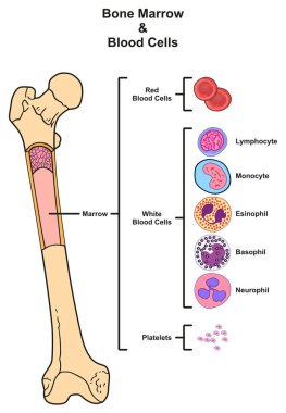 Bone Marrow infographic diagram including femur reproduction of red white blood cells platelets lymphocyte monocyte esinophill basophill neurophill for medical science education clipart