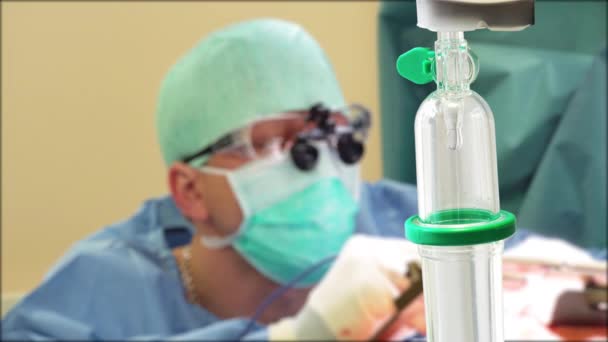 Gotejamento Intravenoso Sala Operação Com Cirurgiões Que Trabalham Com Coagulador — Vídeo de Stock