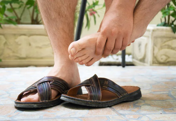 Mann Reibt Sich Die Schmerzenden Müden Füße — Stockfoto