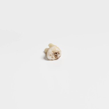 Yırtık kötü kök insan dişi yakın dışarı kadar-beyaz arka plan üzerinde