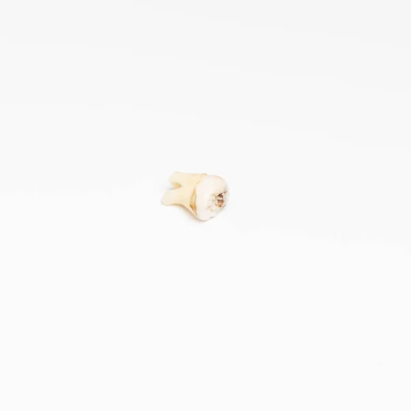 Strappato fuori male radice dente umano da vicino su sfondo bianco — Foto Stock