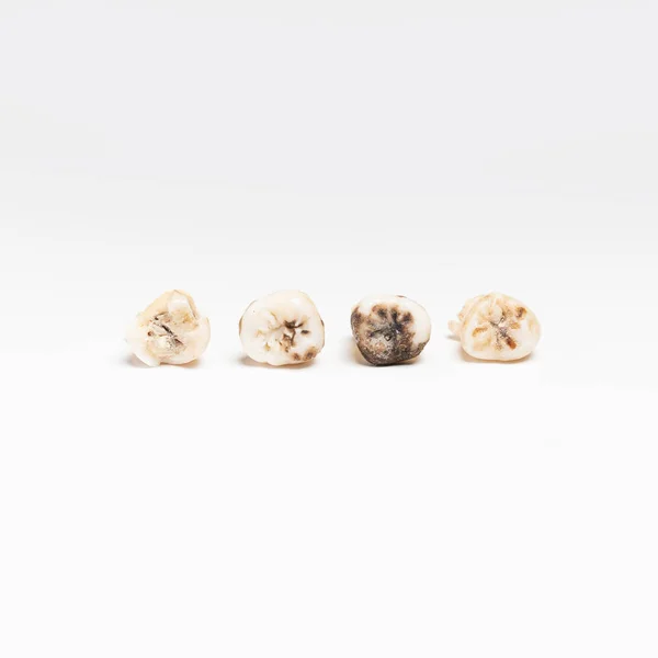 Pulled out bad molars human teeth close up on white background — Stock Photo, Image