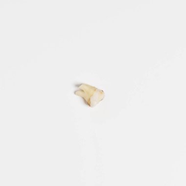 Yırtık kötü kök insan dişi yakın dışarı kadar-beyaz arka plan üzerinde