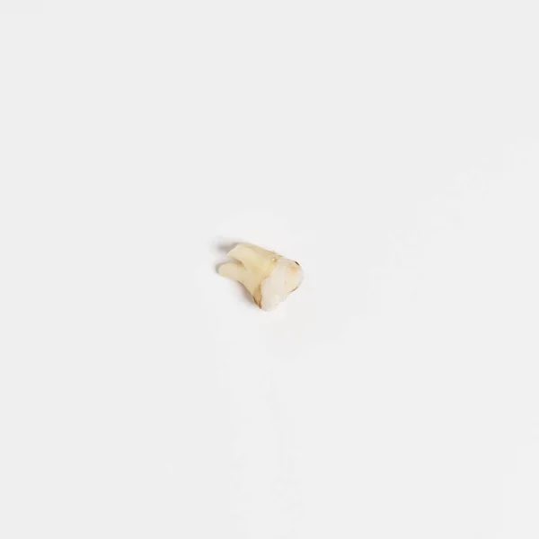 Torn out bad root human tooth close up on white background — Stock Photo, Image