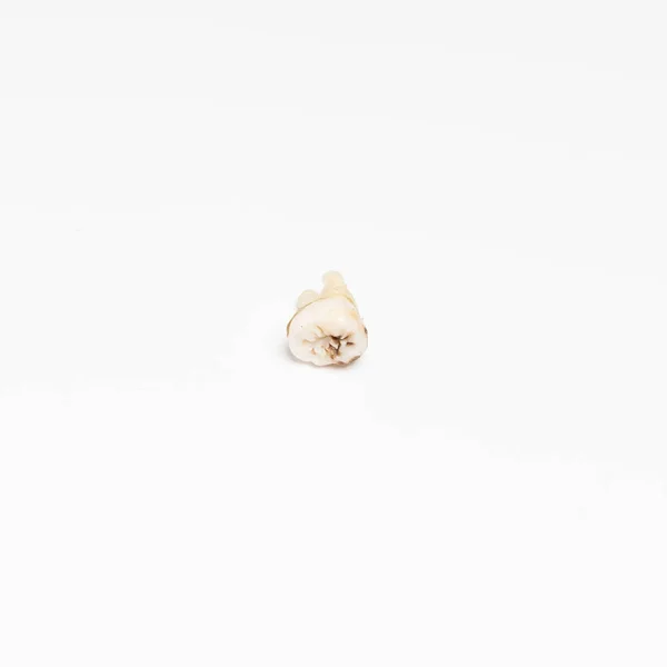 Torn out bad root human tooth close up on white background — Stock Photo, Image