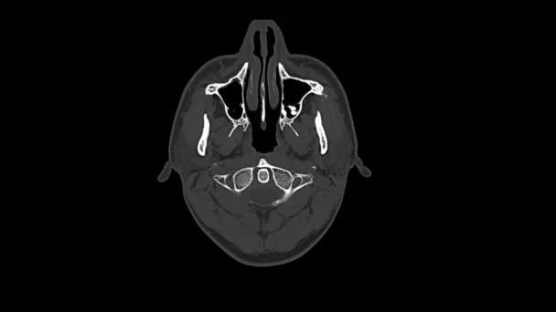 건강 한 남성 머리의 의료 단층 촬영 Mri 스캔을 계산 — 비디오