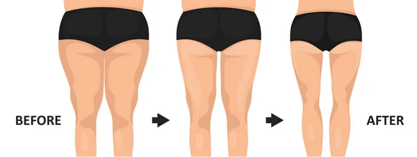 Fatty ass before and after losing weight. Back view. — Stock Vector