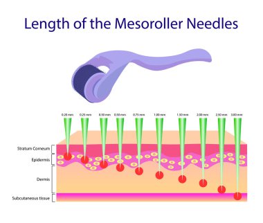 Mesoroller iğneler, vektör çizim uzunluğu