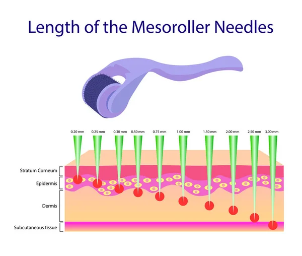 ベクトル図 mesoroller 針の長さ — ストックベクタ