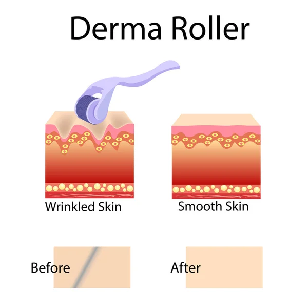 Proceso de mesorolado y estructura celular, antes del efecto posterior — Vector de stock