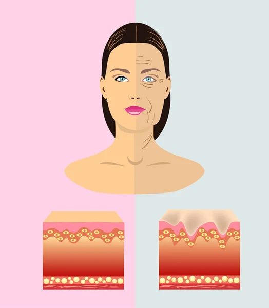 La differenza tra pelle giovane e vecchia, illustrazione vettoriale — Vettoriale Stock
