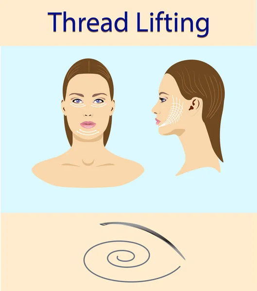 Thread lifting, vector illustration, face of a girl — Stock Vector