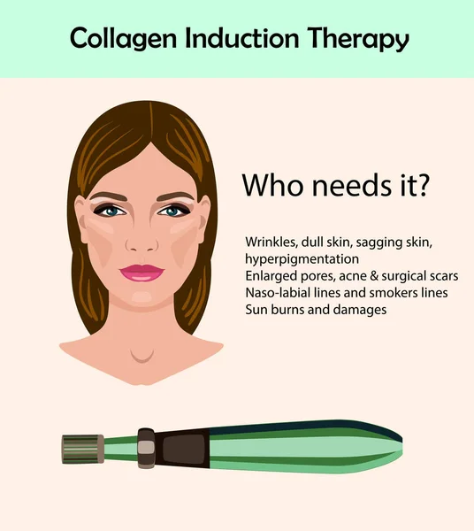 Dermapen. Dispositivo de estampación de microneedle aislado. Terapia de inducción de colágeno — Vector de stock