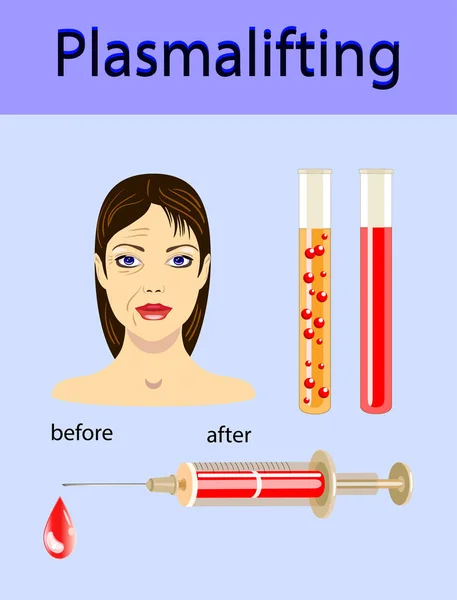 Kosmetologie und Illustration von Schönheitsvektoren. schöne Frau mit Plasma-Lifting-Injektion und Injektor — Stockvektor