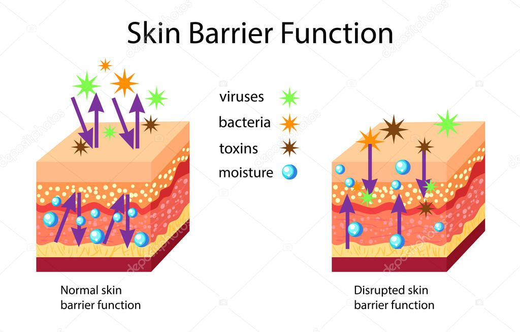 Skin barrier function, normal and disrupted, vector illustration