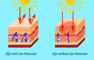Two types of skin with and without sun protection, sunburn, vector illustration clipart