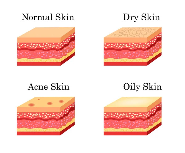 Σετ εικονιδίων τύπους επιδερμίδας. Απόθεμα Ενδεικτικά διανυσματική — Διανυσματικό Αρχείο