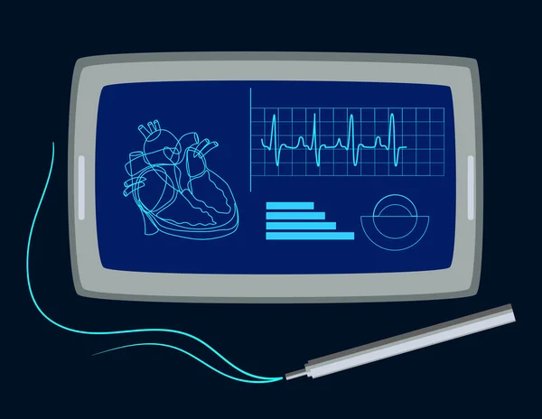 Illustrazione intelligente del dispositivo di inseguimento di idoneità con il monitor di frequenza cardiaca, stile piatto del vettore del fumetto — Vettoriale Stock