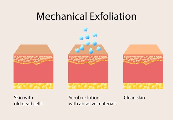 Mechanische exfoliëring of peeling, vector illustratie op lichte achtergrond — Stockvector