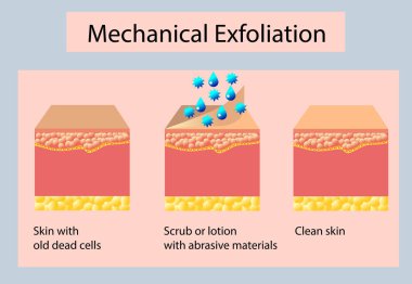 Mekanik peeling veya peeling, hafif arka plan üzerinde vektör illüstrasyon