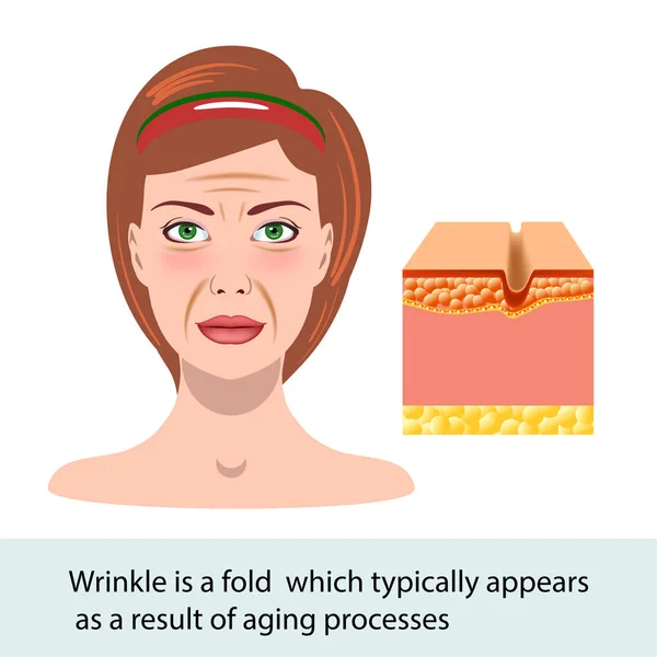 Infographic skin illustration. Wrinkle, change of the face, vector — Stock Vector