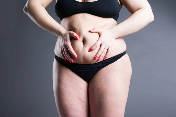Overgewicht Vrouw Met Dikke Buik Obesitas Vrouwelijk Lichaam Grijze Achtergrond — Stockfoto