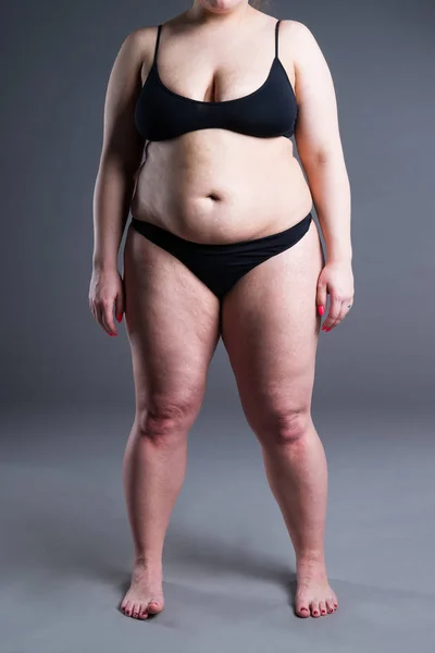 Nadwagę Kobieta Tłuszczu Brzucha Otyłość Kobiecego Ciała Szarym Tle — Zdjęcie stockowe