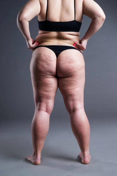 Grasso Corpo Femminile Con Cellulite Schiena Sovrappeso Fianchi Glutei Sfondo — Foto Stock