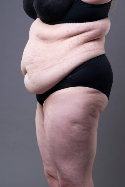 Şişman karın ile obez kadın kilolu kadın mide gri studio arka plan üzerinde