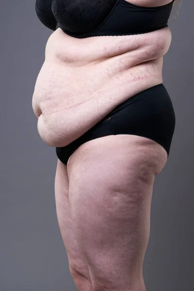 Donna Obesa Con Addome Grasso Sovrappeso Stomaco Femminile Sfondo Grigio — Foto Stock