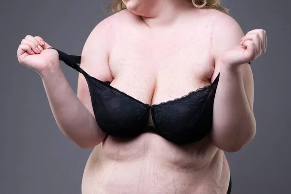 Stretch marks on a large natural breasts, obese woman with fat abdomen, overweight female body on gray studio background