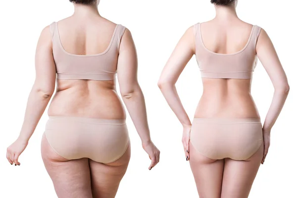 Cuerpo Mujer Antes Después Pérdida Peso Aislado Sobre Fondo Blanco —  Fotos de Stock