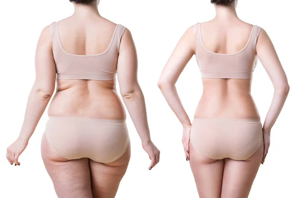 Kadın vücudu önce ve sonra beyaz arka plan üzerinde plastik cerrahi kavramı izole kilo kaybı