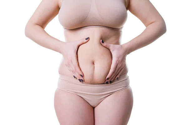 Mulher Segurando Dobra Pele Celulite Corpo Feminino Isolado Fundo Branco — Fotografia de Stock
