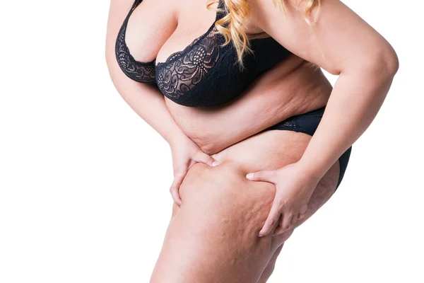Mujer Con Sobrepeso Muslos Gordos Obesidad Piernas Femeninas Aisladas Sobre — Foto de Stock