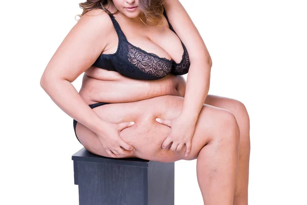Yağ Uyluk Obezite Kadın Bacaklar Beyaz Arka Plan Üzerinde Izole — Stok fotoğraf