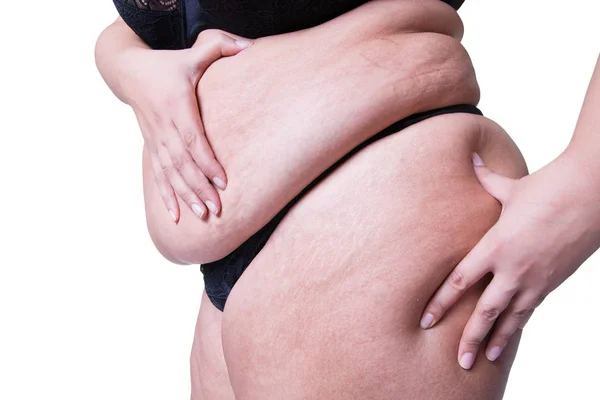 Overgewicht Vrouw Met Dikke Buik Vrouwelijk Lichaam Obesitas Geïsoleerd Witte — Stockfoto