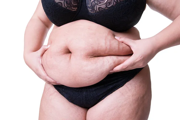 Mujer Con Sobrepeso Vientre Gordo Obesidad Cuerpo Femenino Aislado Sobre — Foto de Stock