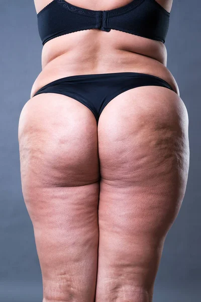 Selülit, kilolu sırt, kalça ve kalça gri arka plan, arka görüş ile şişman kadın bedeni