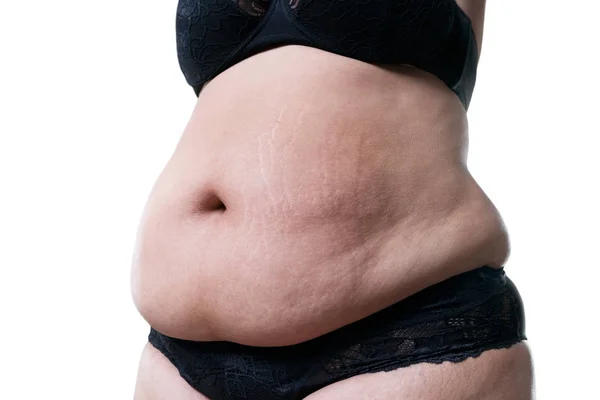 Mujer Con Sobrepeso Con Vientre Gordo Obesidad Estómago Femenino Aislado — Foto de Stock