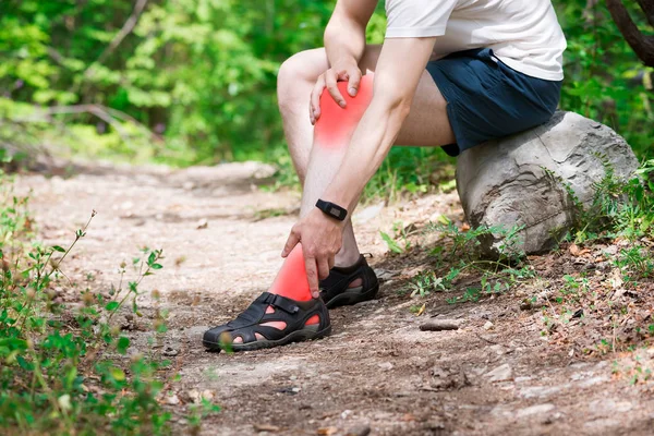 Bolest Kolena Zánět Kloubů Masáž Mužské Nohy Zranění Při Běhu — Stock fotografie
