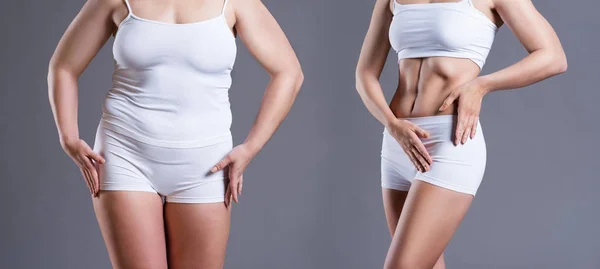 Corpo Della Donna Prima Dopo Perdita Peso Sfondo Grigio Concetto — Foto Stock