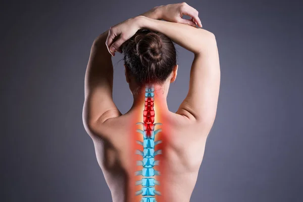 脊椎疼痛 女性背痛在灰色背景 背部受伤 照片与突出的骨架 — 图库照片
