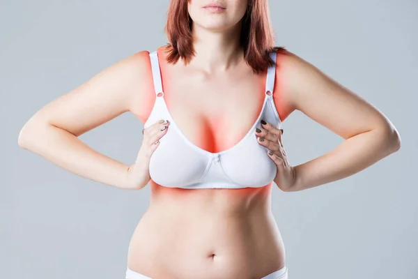 Donna Con Pelle Irritata Sotto Reggiseno Irritazione Sul Corpo Biancheria — Foto Stock