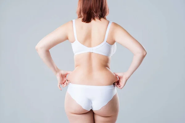 Obézní Žena Tuku Zpět Hýždě Obezita Ženské Tělo Šedém Pozadí — Stock fotografie