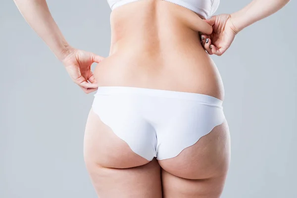 Υπέρβαρη Γυναίκα Λίπος Πίσω Και Γλουτούς Παχυσαρκία Γυναικείο Σώμα Γκρίζο — Φωτογραφία Αρχείου