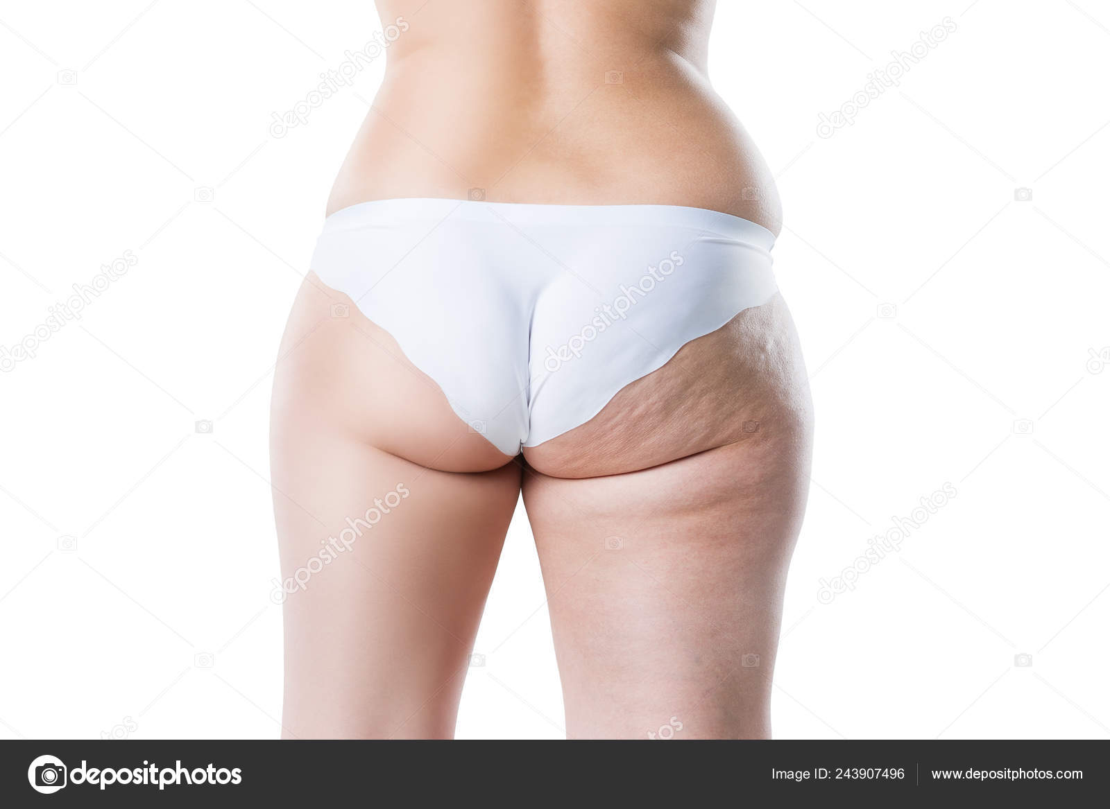 Fat Cellulite Butts