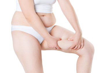 Yağ uyluk, obezite kadın bacaklar beyaz arka plan üzerinde izole kadın kilolu