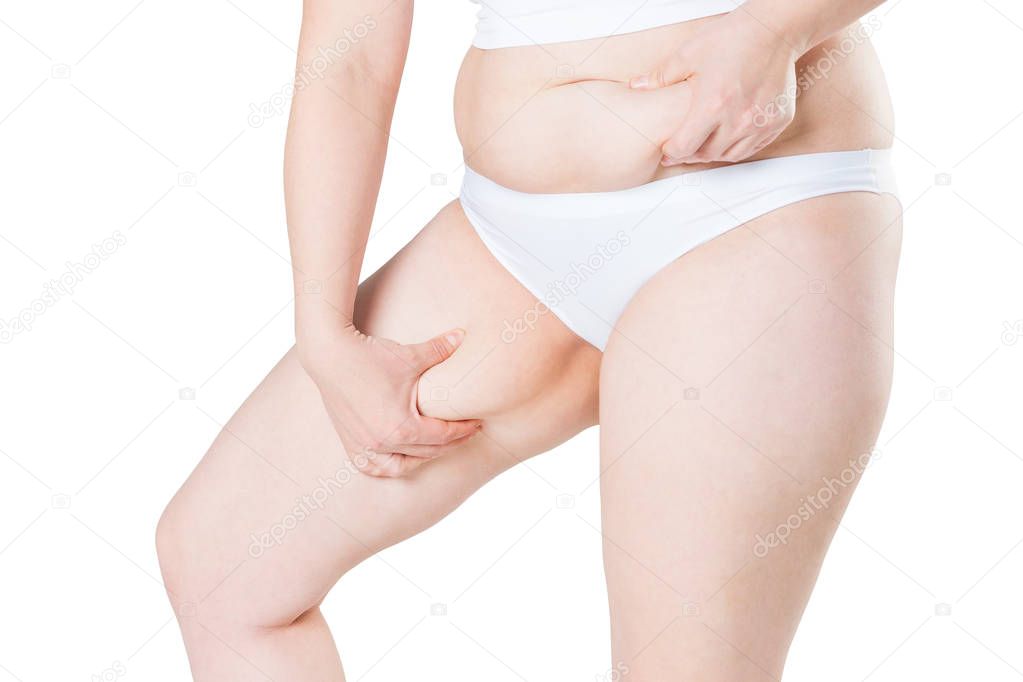 Overweight woman with fat thighs, obesity female legs isolated on white background