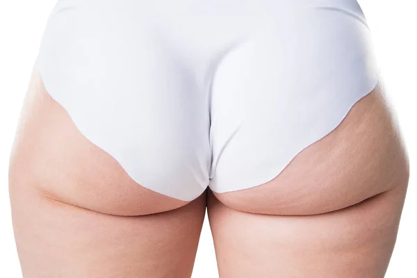 Feta skinkorna närbild, fetma kvinnliga kroppen isolerad på vit bakgrund — Stockfoto